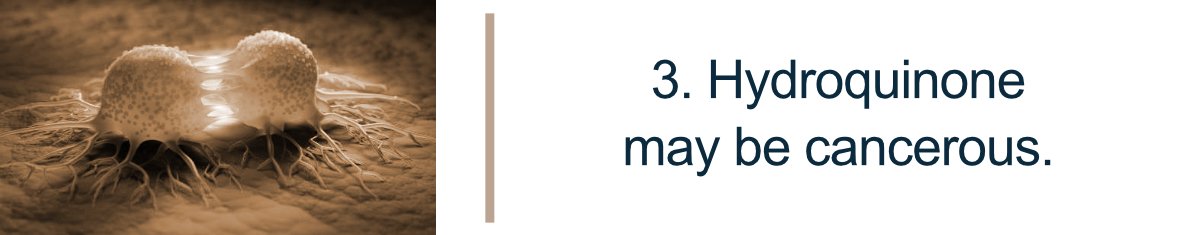 3. Hydroquinone may be cancerous.