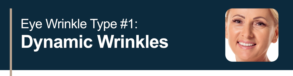 Eye Wrinkle Type #1: Dynamic Wrinkles