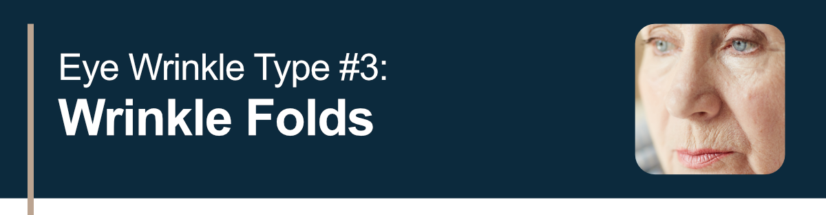 Eye Wrinkle Type #3. Wrinkle Folds