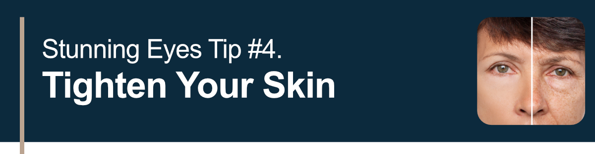 Stunning Eyes Tip #4. Tighten Your Skin